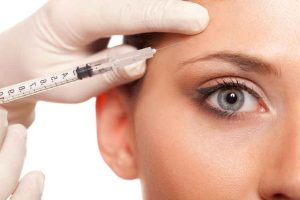 inyección de botox en una mujer. ¿Cual es el funcionamiento del botox?