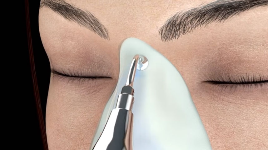 ¿Rinoplastia Ultrasónica o Convencional en Valencia con el Dr.Moltó?