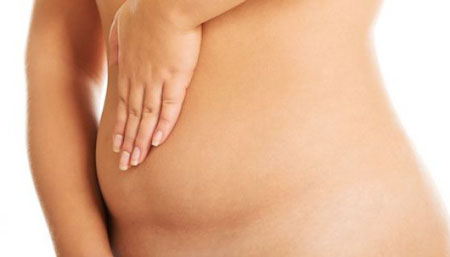 la hinchazon tras la liposucción de cartucheras, piernas o abdomen desaparece paso a paso y día a día