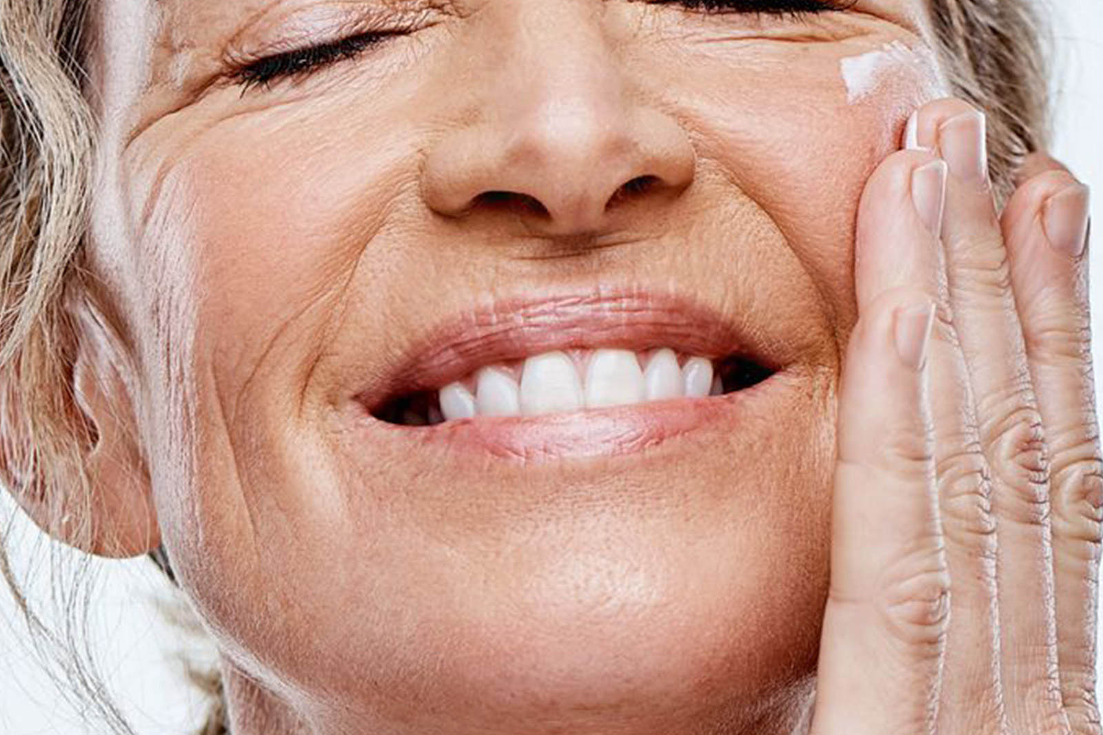 Lipofilling surco nasogeniano