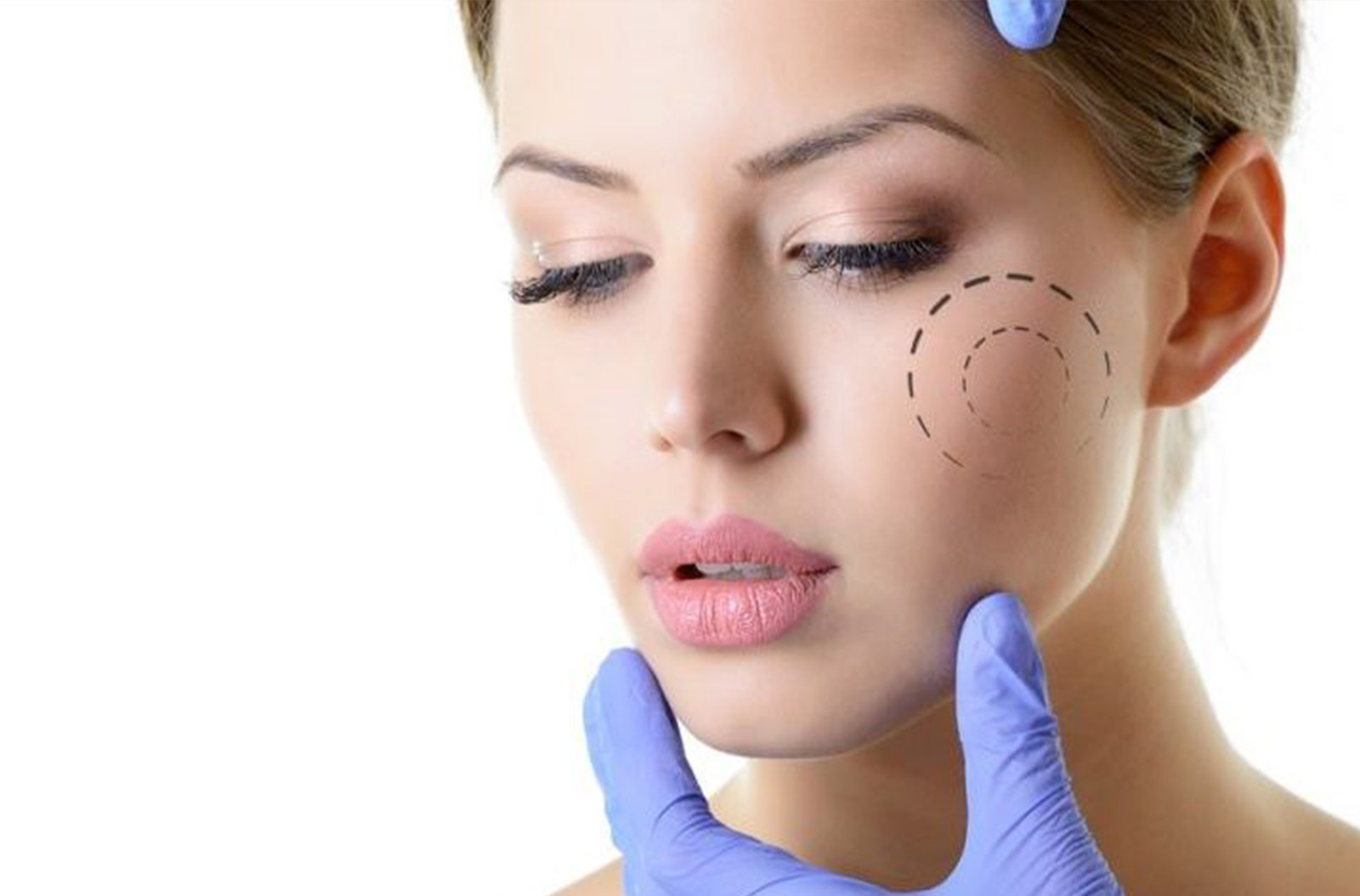 Hifu facial: Cuánto dura y efectos secundarios