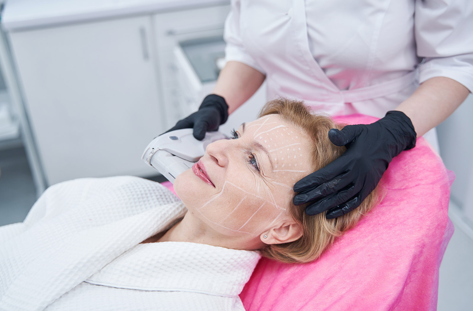 HIFU facial en Valencia y Gandía: Rejuvenecimiento sin cirugía